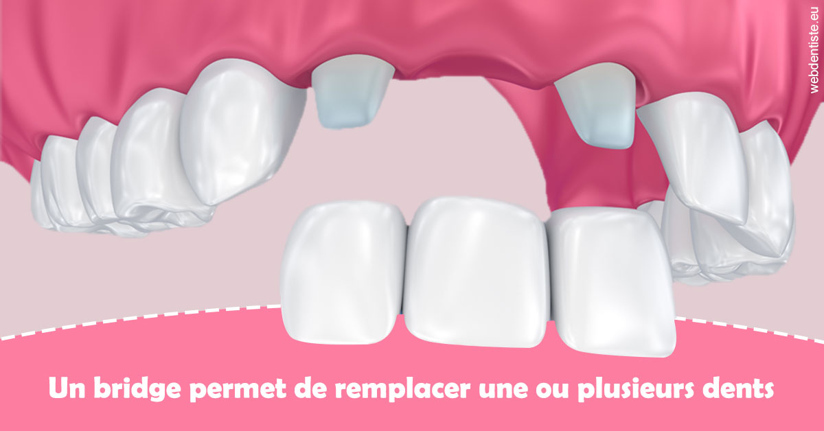 https://selarl-cabinet-sayac-et-associes.chirurgiens-dentistes.fr/Bridge remplacer dents 2