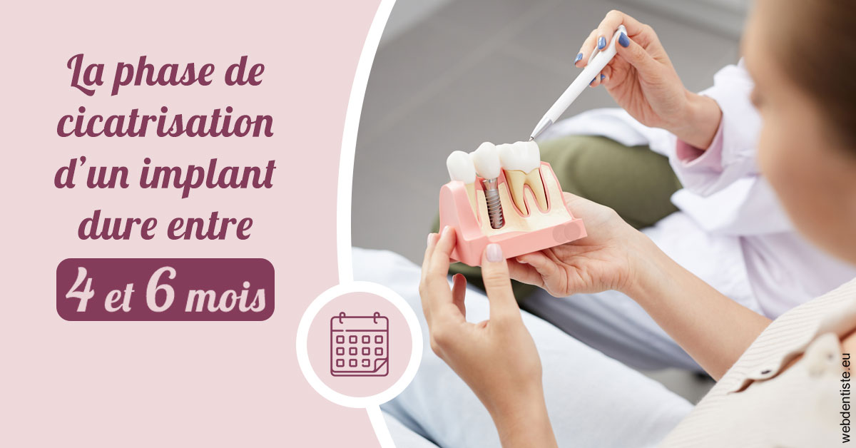 https://selarl-cabinet-sayac-et-associes.chirurgiens-dentistes.fr/Cicatrisation implant 2