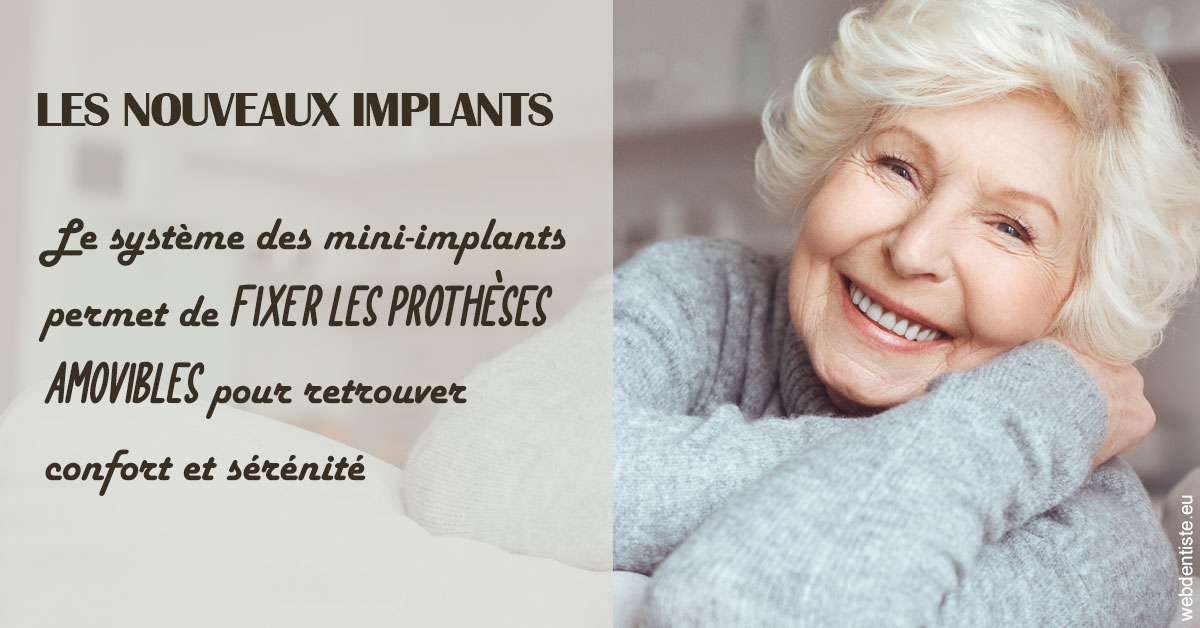 https://selarl-cabinet-sayac-et-associes.chirurgiens-dentistes.fr/Les nouveaux implants 1