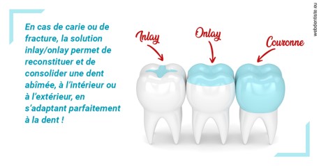 https://selarl-cabinet-sayac-et-associes.chirurgiens-dentistes.fr/L'INLAY ou l'ONLAY