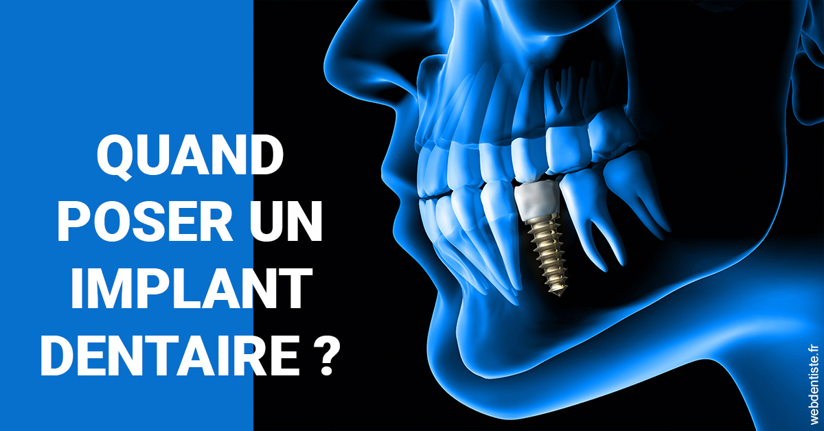 https://selarl-cabinet-sayac-et-associes.chirurgiens-dentistes.fr/Les implants 1