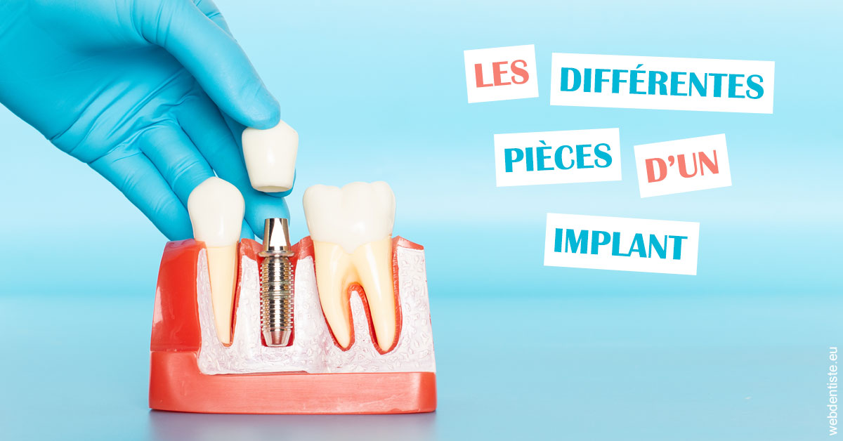 https://selarl-cabinet-sayac-et-associes.chirurgiens-dentistes.fr/Les différentes pièces d’un implant 2