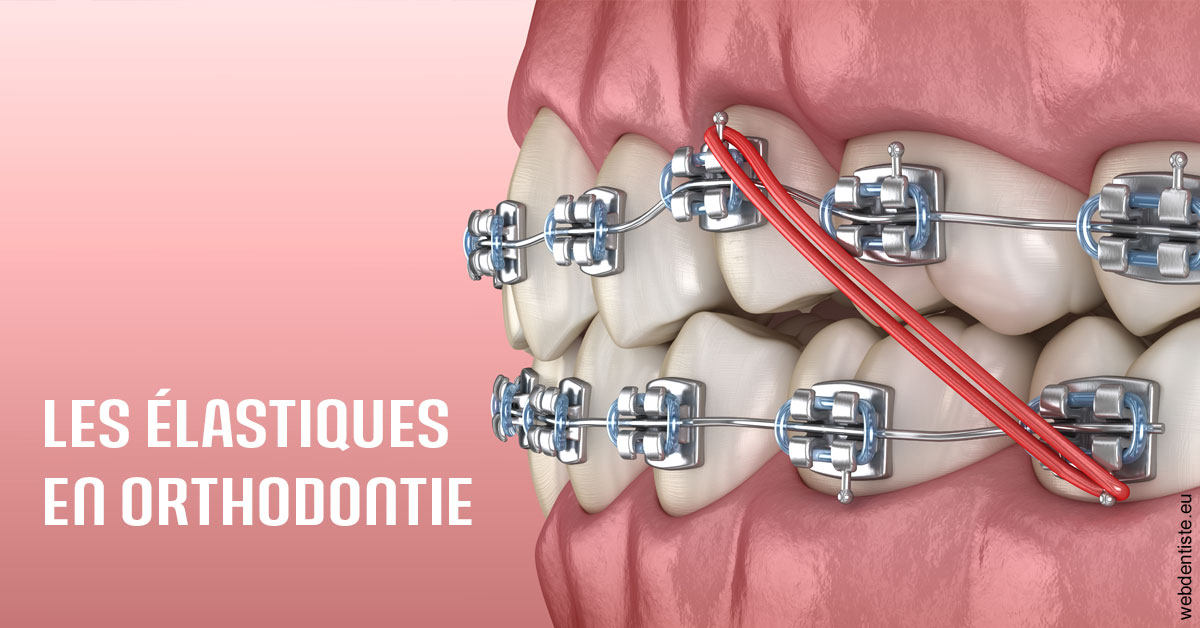 https://selarl-cabinet-sayac-et-associes.chirurgiens-dentistes.fr/Elastiques orthodontie 2