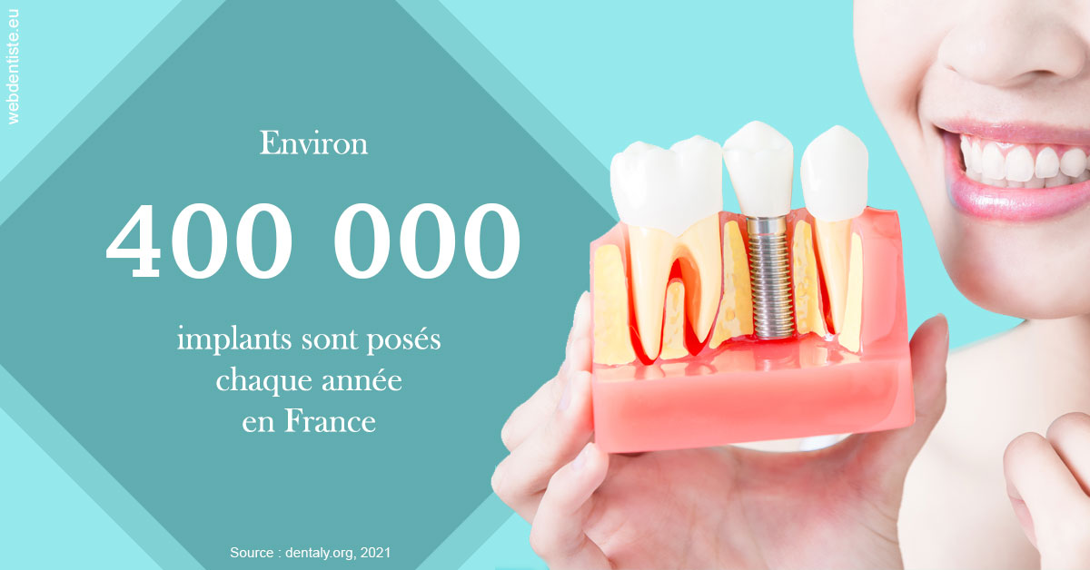 https://selarl-cabinet-sayac-et-associes.chirurgiens-dentistes.fr/Pose d'implants en France 2