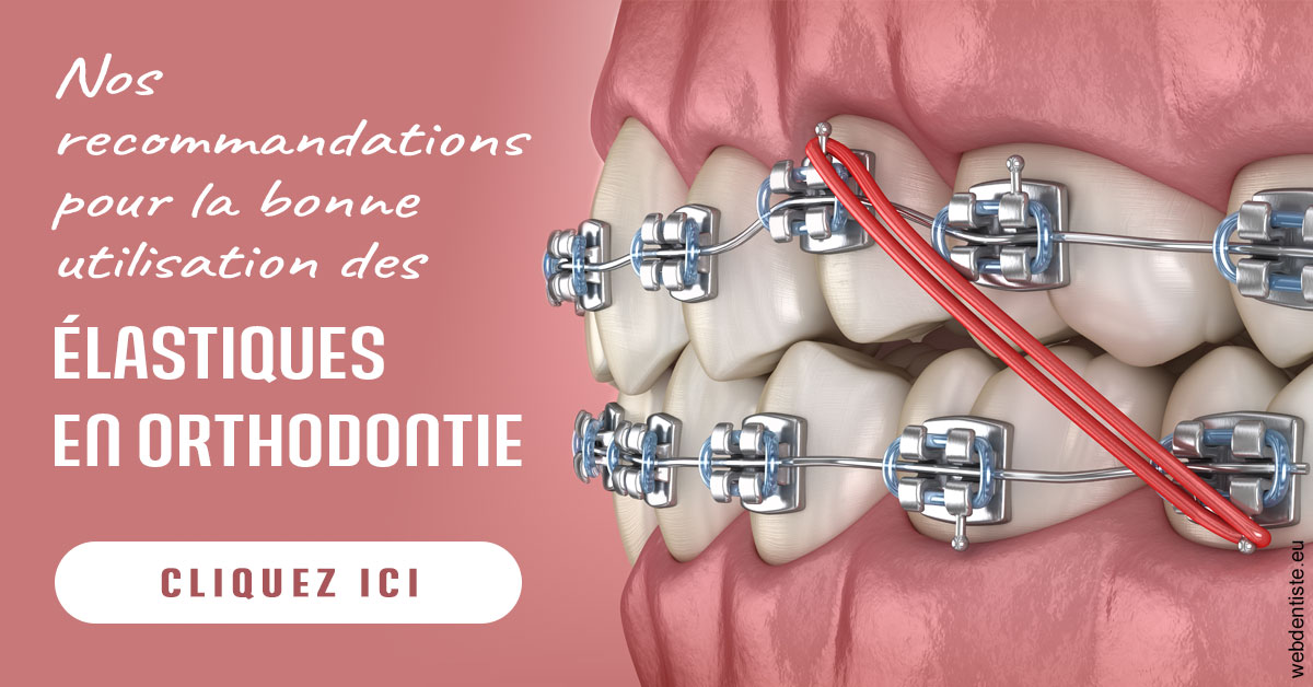 https://selarl-cabinet-sayac-et-associes.chirurgiens-dentistes.fr/Elastiques orthodontie 2